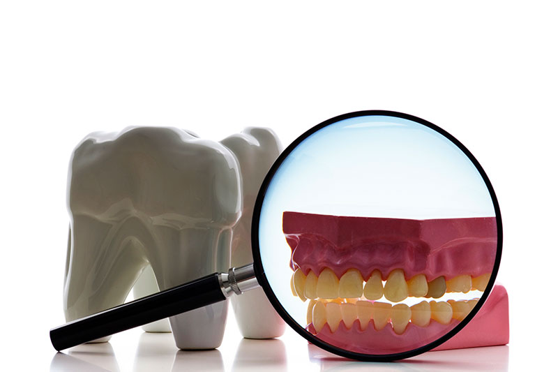 Root Canal in Beckley